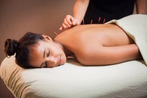 10 Reasons Women Should Try Acupuncture